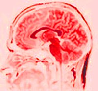 IPB Image